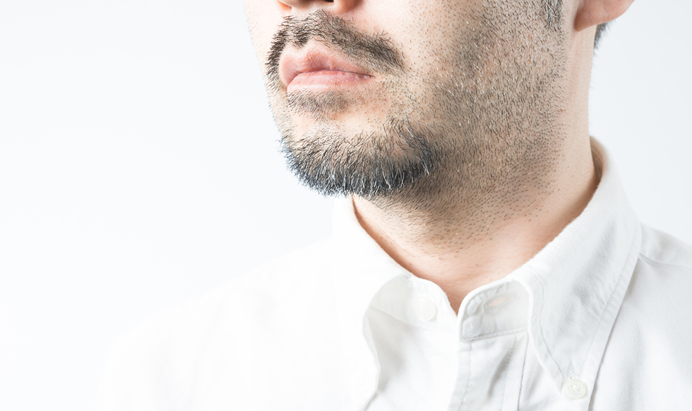 髭剃りでカミソリ負けが… 治すための方法と注意点